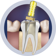 endodontikes-pathiseis